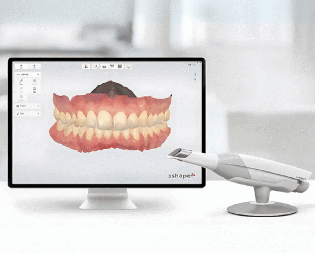 Scanner intra-oral 3Shape TRIOS pour empreinte dentaire numérique en orthodontie