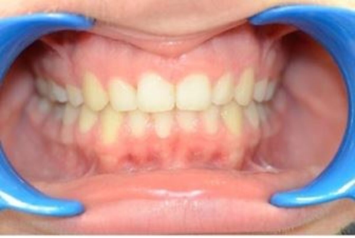 Examen orthodontique des dents du patient au cabinet du Dr Wees à Caen.